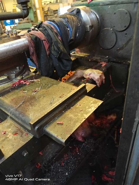Cameron Minshull became trapped in factory machine. . Man caught in lathe machine